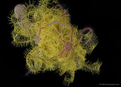 Macrophiothrix sp. "cf. nereidina" • © CMBS photography team • All Rights Reserved