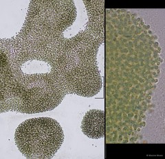 Microcystis aeruginosa